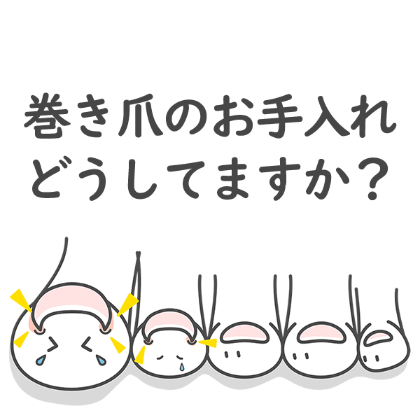 「巻き爪」って何？原因は？正しい爪の切り方や歩き方など対策は？